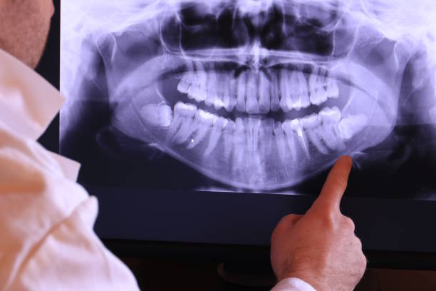 Dentist for Dental Trauma in TN
