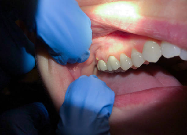 Best Knocked-Out Tooth Emergency  in Englewood, TN