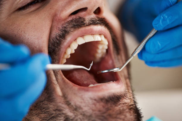 Best Urgent Tooth Repair  in Englewood, TN